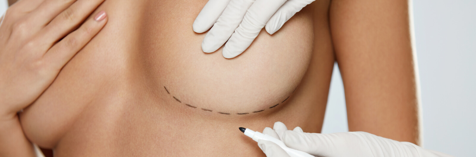 breast.brustverkleinerung