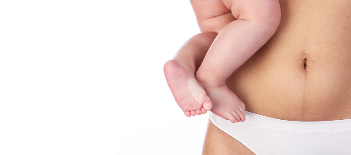 body.mommy_makeover